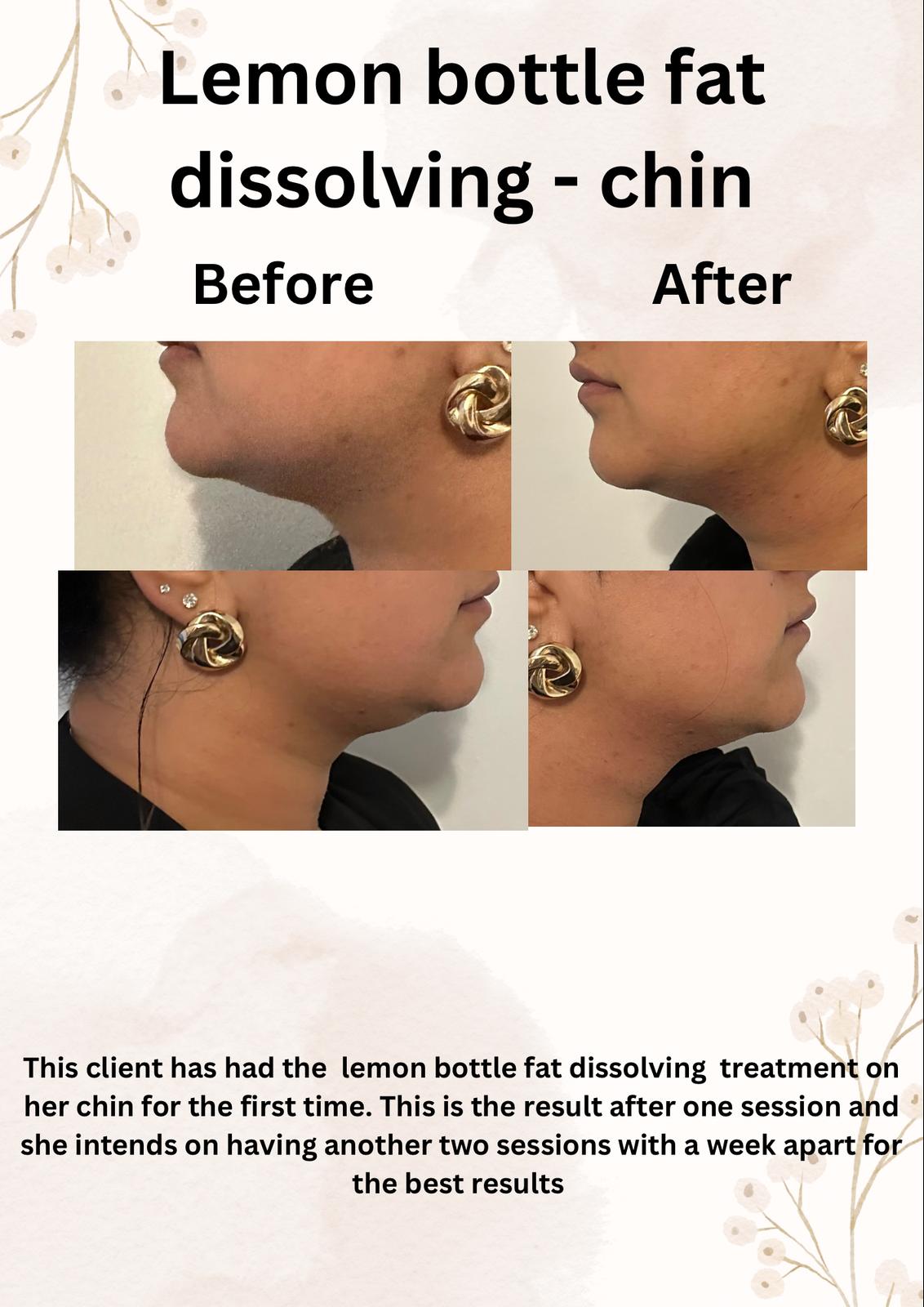 WhatsApp Image 2025-02-24 at 20.42.29_62153e2c